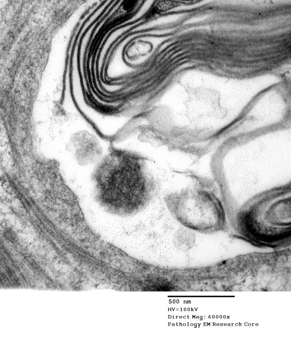 1B4 (Case 1) EM079 - Copy