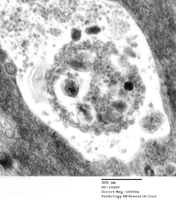 1B5 (Case 1) EM087 - Copy