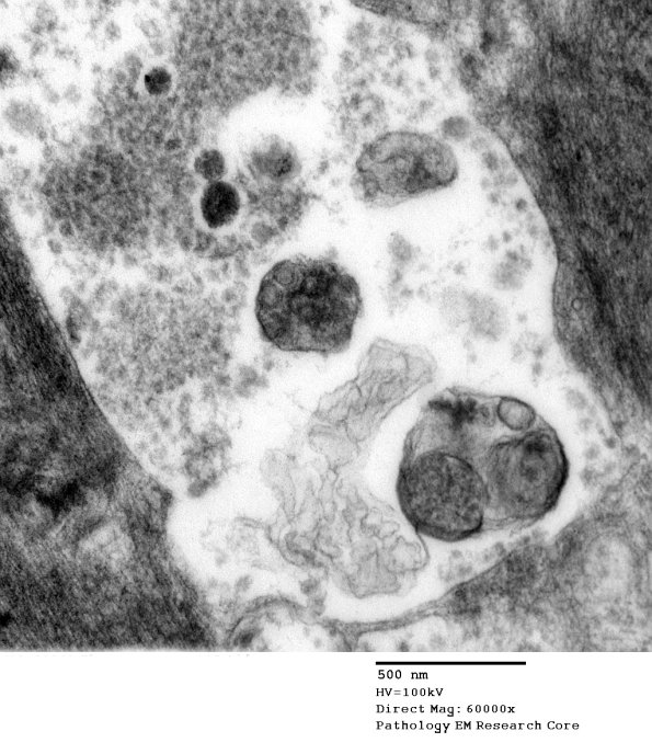 1B6 (Case 1) EM085 - Copy