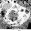 1B7 (Case 1) EM077 - Copy