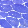 4A1A (Case 4) Muscle 60X 3