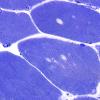 4A1B (Case 4) Muscle 100X 2