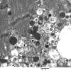 4B1B (Case 4) Muscle_013 - Copy
