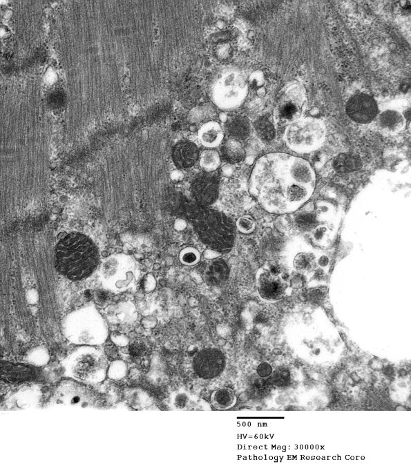 4B1B (Case 4) Muscle_013 - Copy