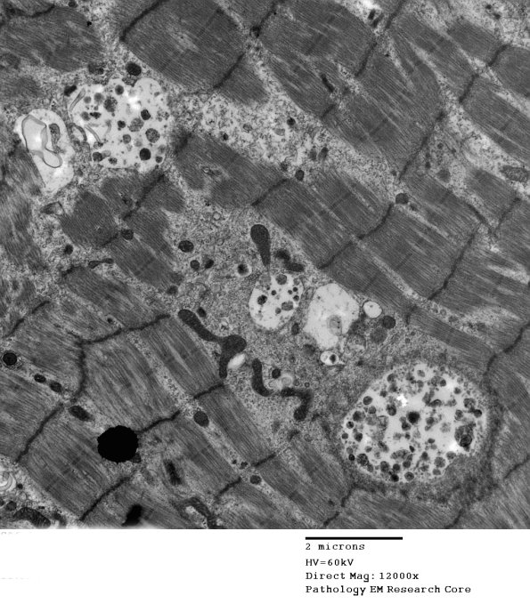 4B2A (Case 4) Muscle_003 - Copy