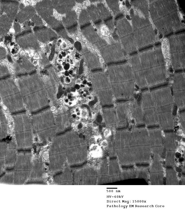4B3A (Case 4) Muscle_010 - Copy