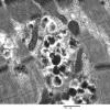 4B3B (Case 4) Muscle_011 - Copy