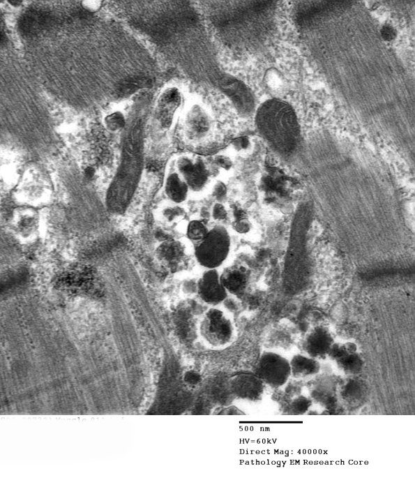 4B3B (Case 4) Muscle_011 - Copy