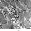 4B4B (Case 4) Muscle_001 - Copy