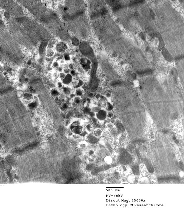 4B4B (Case 4) Muscle_001 - Copy
