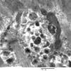 4B4B (Case 4) Muscle_002 - Copy