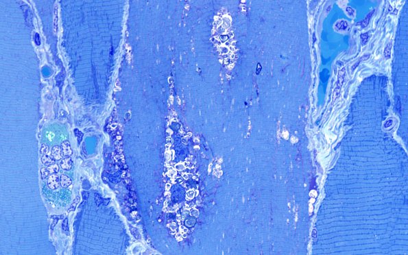 6B1C (Case 6) Plastic 100X 4