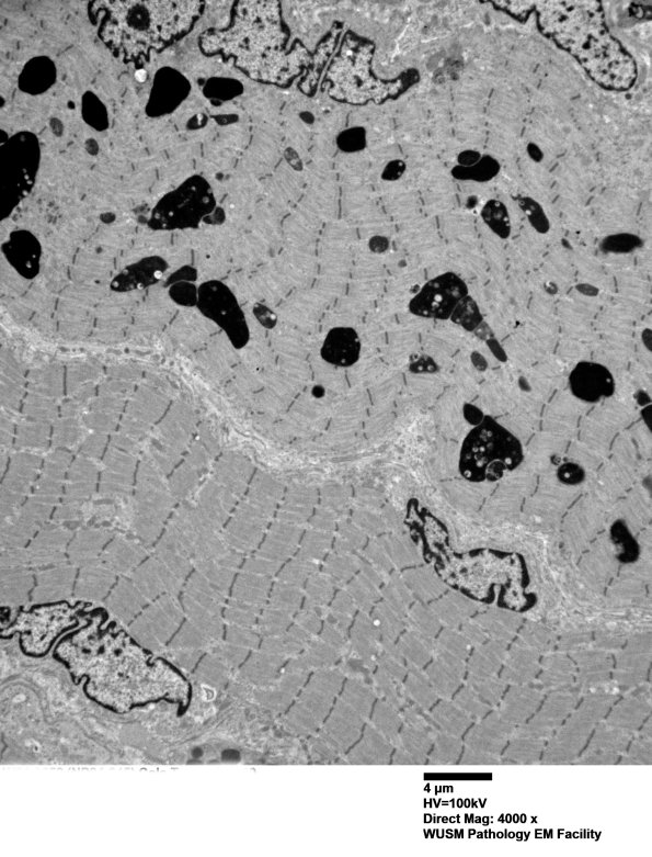 7S1B (Case 7) muscle_010 - Copy