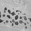 7S1C (Case 7) T muscle_032 - Copy