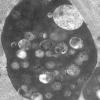 7S1E (Case 7) muscle_042 - Copy