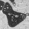 7S2A (Case 7) muscle_036 - Copy