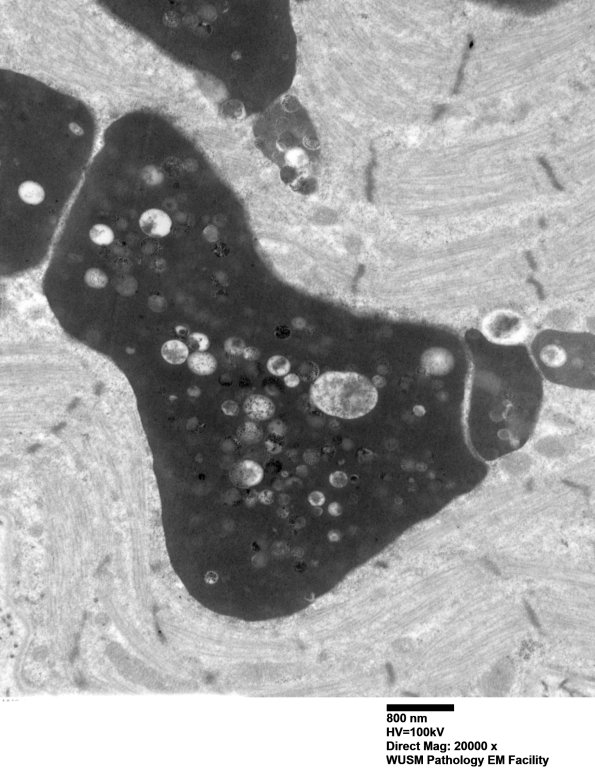 7S2A (Case 7) muscle_036 - Copy