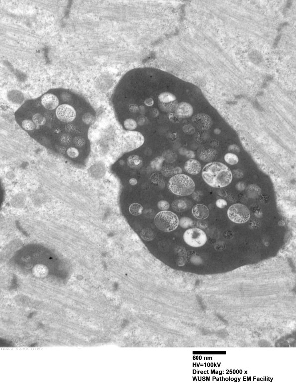 7S2C (Case 7) muscle_049 - Copy