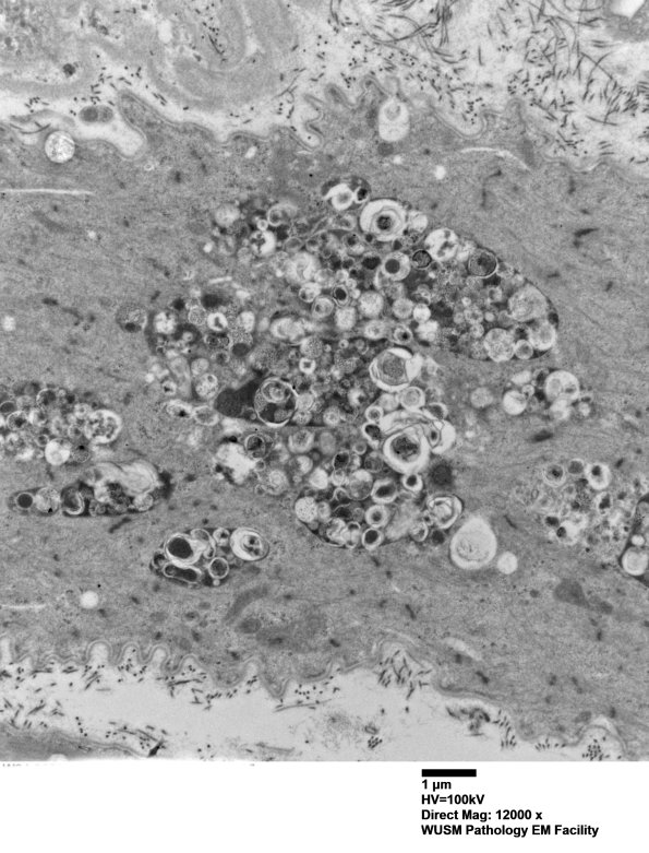 7S3A (Case 7) muscle_025 - Copy