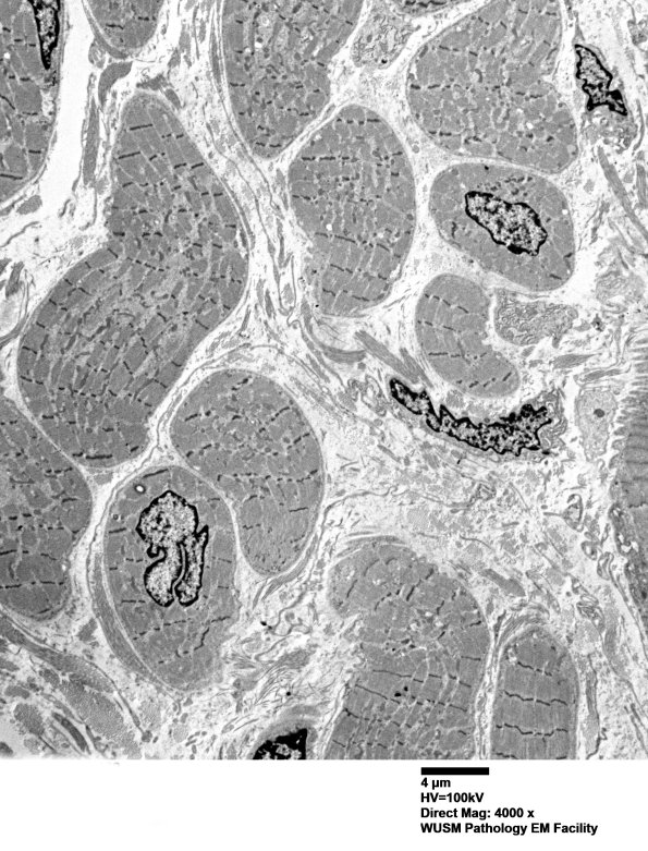 1C1C (Case 1) EM 002 - Copy