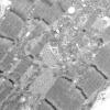 1C8A (Case 1) EM Muscle_011 - Copy