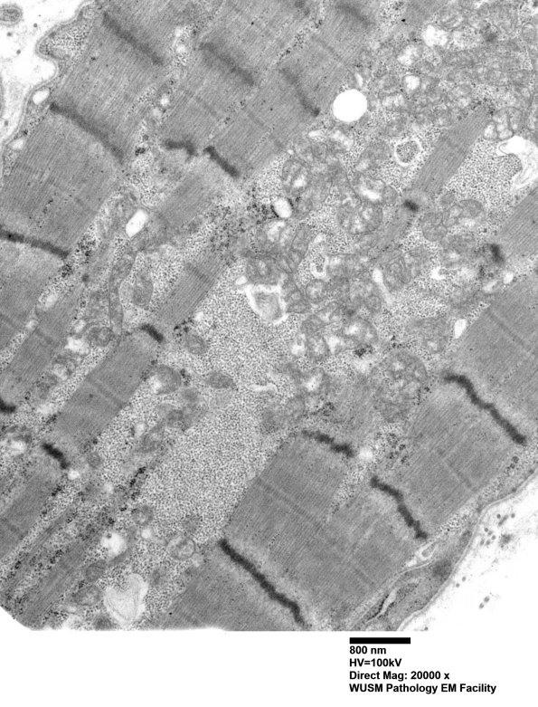 1C8A (Case 1) EM Muscle_011 - Copy