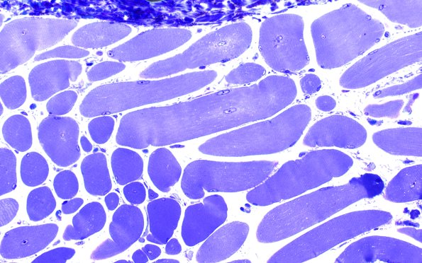 2B2 Centronuclear Myopathy (Case 2) Plastic 40X 2