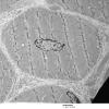 2C3 Case 2 Centronuclear Myopathy_EM014 - Copy