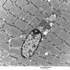 2C5B Case 2 Centronuclear Myopathy_EM019 - Copy