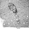 2C7A Case 2 Centronuclear Myopathy_EM006 - Copy