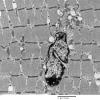 2C8 Case 2 Centronuclear Myopathy_EM004 - Copy