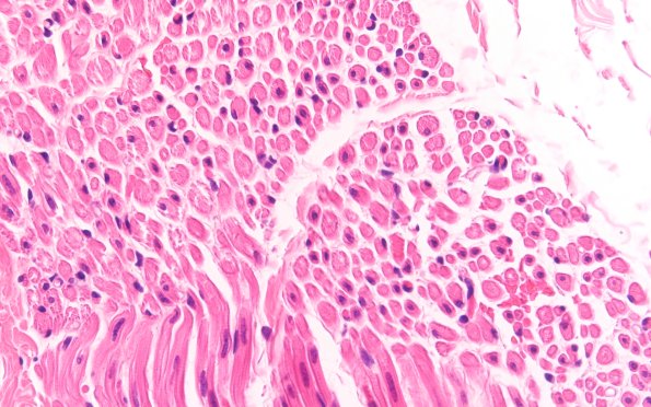 3A3 Centronuclear Myopathy (Case 3) H&E 60X 2
