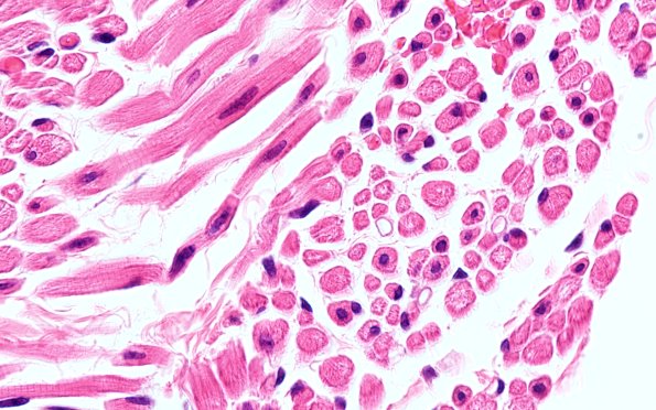 3A5 Centronuclear Myopathy (Case 3) H&E 100X 2