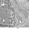 1C3B Cystinosis (Case 1) EM034 - Copy