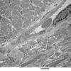 1C5A Cystinosis (Case 1) EM042 - Copy