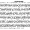 0A0 Dermatomyositis - Text