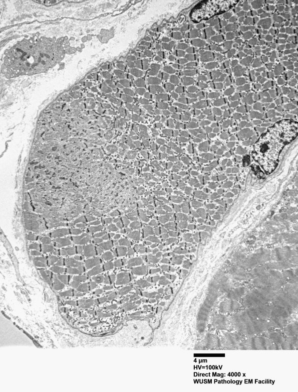 1I1A Case 1 001 - Copy