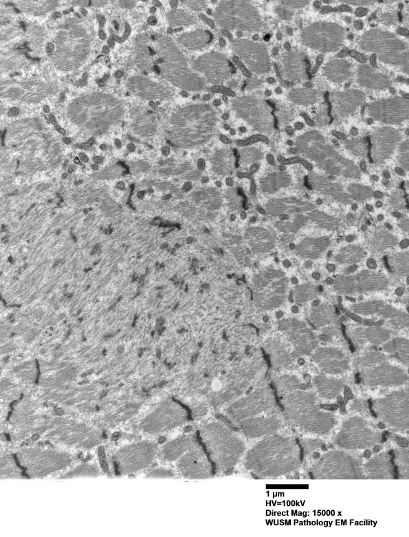 1I1B Case 1 002 - Copy