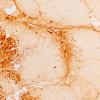 2J1 Atrophy, Perifascicular (Case 2) LC3 4X