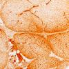 2K1 Atrophy, Perifascicular (Case 2) MHC1 4X