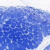 2L2 Atrophy, Perifascicular (Case 2) Plastic 4