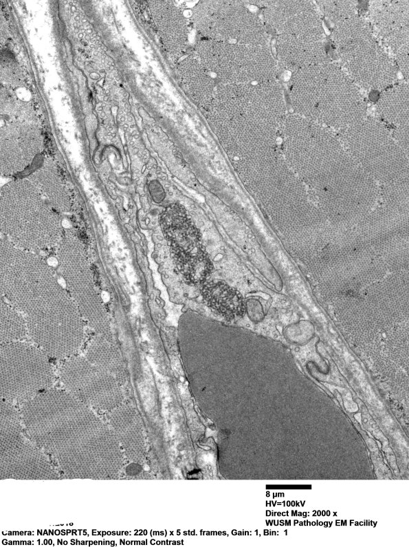 2M1B (Case 2) TRI EM 005 - Copy