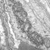 2M1C (Case 2) TRI EM 015 - Copy