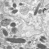 2M7B (Case 2 EM 037 - Copy - Copy