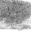 3C7B Inclusions,dermatomyositis (Case 3) 017A - Copy