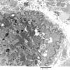 3C7C Inclusions,dermatomyositis (Case 3) 016A - Copy