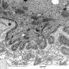 3C7D Inclusions,dermatomyositis (Case 3) 018A - Copy