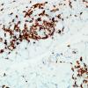 4C3Dermatomyositis-Case-4-CD3-1.jpg