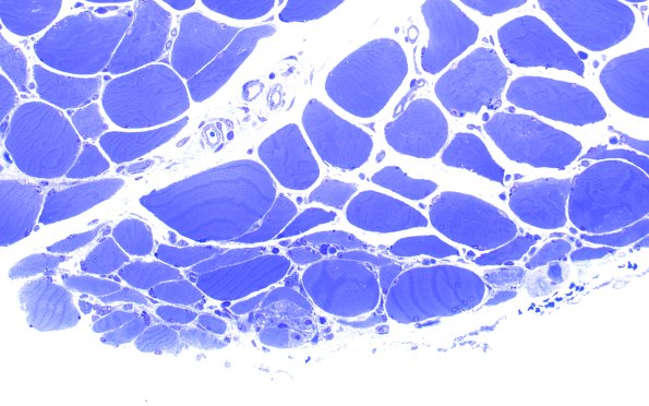 6B2 Dermato (NP22-958) Plastic 40X