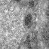 6C1D (Case 6) Muscle_005 - Copy